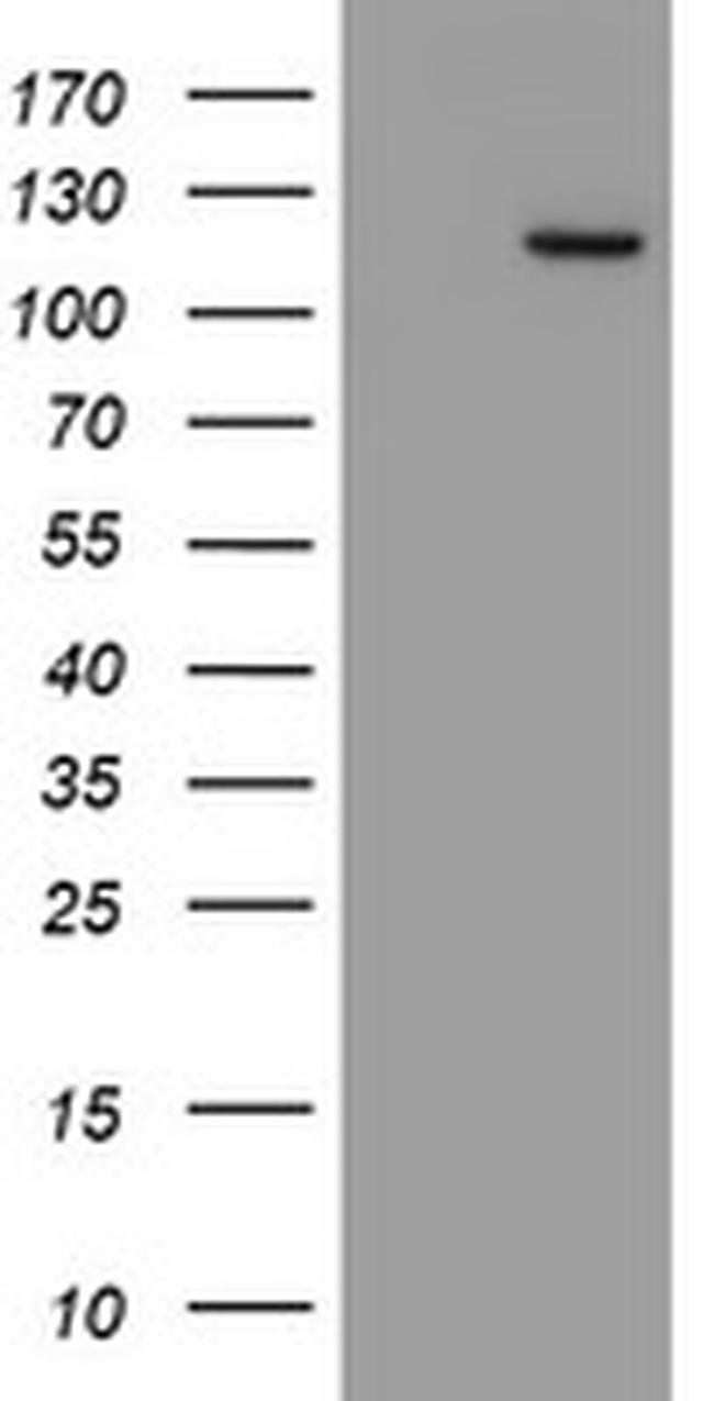 MYNN Antibody in Western Blot (WB)