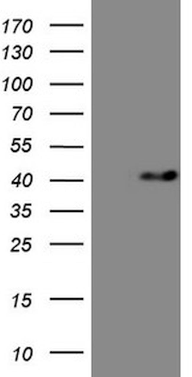 MYOZ1 Antibody in Western Blot (WB)