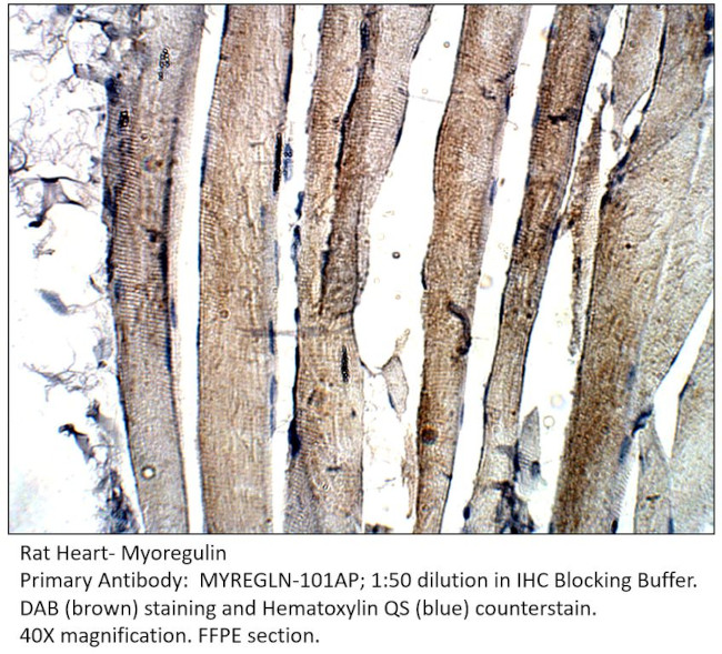 Myoregulin Antibody in Immunohistochemistry (IHC)