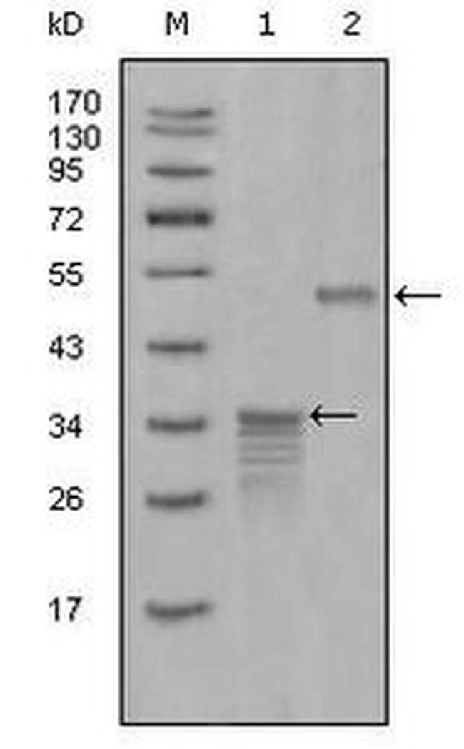 Mammaglobin A Antibody in Western Blot (WB)