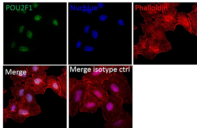 Donkey anti-Mouse IgG (H+L) Highly Cross-Adsorbed, Alexa Fluor 