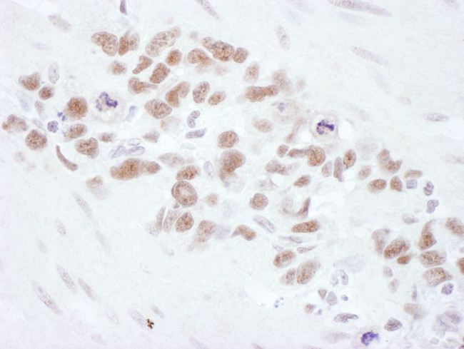 Mre11 Antibody in Immunohistochemistry (IHC)