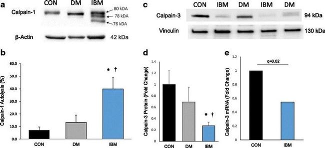 Mu-Calpain Antibody in Western Blot (WB)