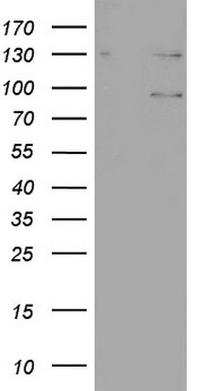 N4BP2L2 Antibody in Western Blot (WB)