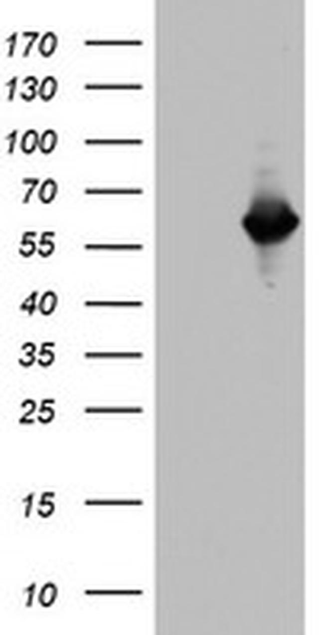 NAB1 Antibody in Western Blot (WB)