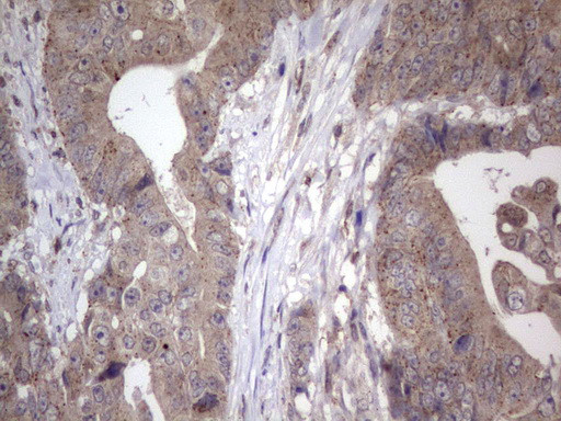 NAB2 Antibody in Immunohistochemistry (Paraffin) (IHC (P))