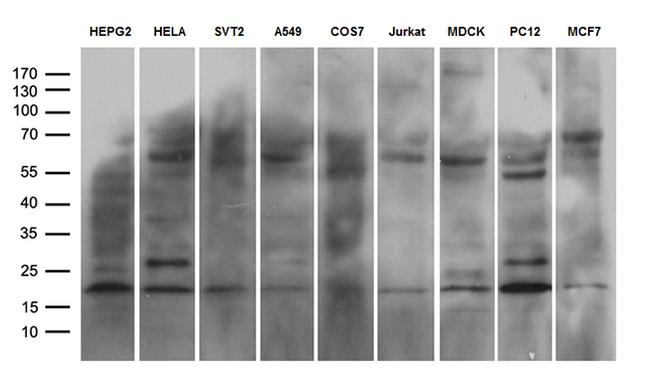 NABP1 Antibody in Western Blot (WB)