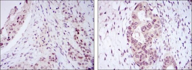 NAC1 Antibody in Immunohistochemistry (Paraffin) (IHC (P))