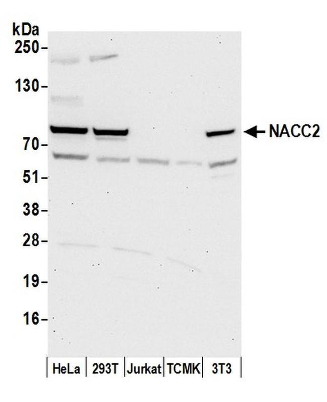 NACC2/BTBD14A Antibody in Western Blot (WB)