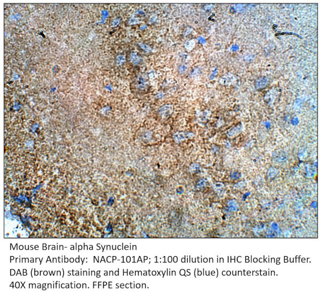 Alpha Synuclein Antibody in Immunohistochemistry (IHC)