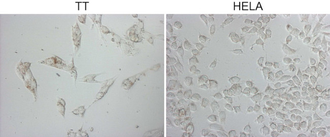 NAPSA Antibody in Immunocytochemistry (ICC/IF)