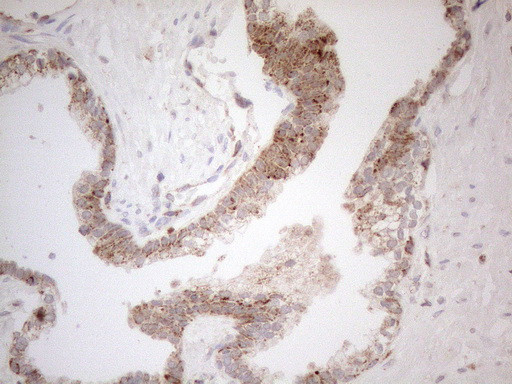 NAPSA Antibody in Immunohistochemistry (Paraffin) (IHC (P))