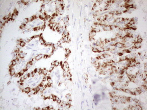 NAPSA Antibody in Immunohistochemistry (Paraffin) (IHC (P))