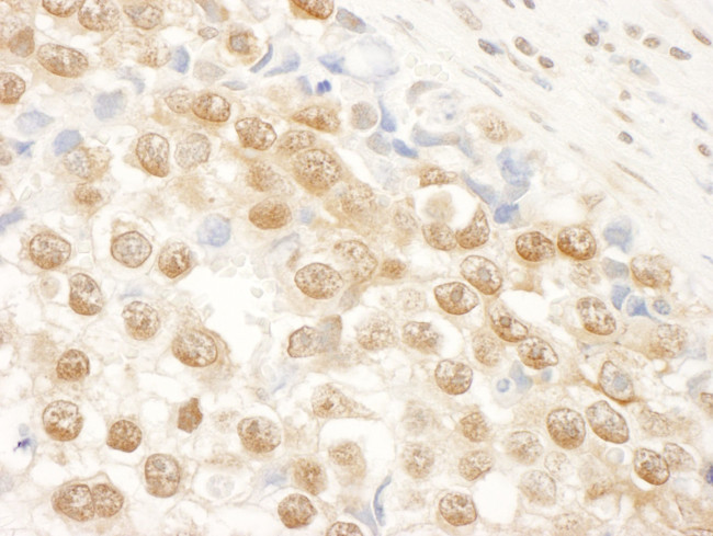 NARG1 Antibody in Immunohistochemistry (IHC)