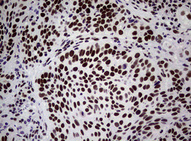 NBN Antibody in Immunohistochemistry (Paraffin) (IHC (P))