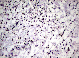 NBN Antibody in Immunohistochemistry (Paraffin) (IHC (P))