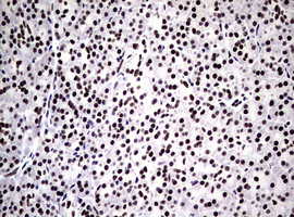 NBN Antibody in Immunohistochemistry (Paraffin) (IHC (P))