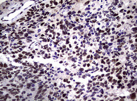 NBN Antibody in Immunohistochemistry (Paraffin) (IHC (P))