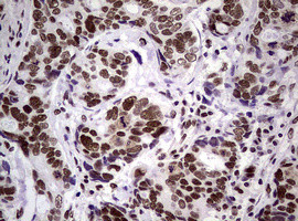 NBN Antibody in Immunohistochemistry (Paraffin) (IHC (P))