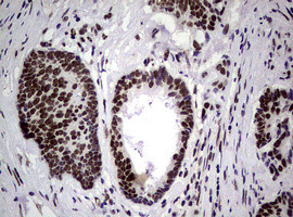 NBN Antibody in Immunohistochemistry (Paraffin) (IHC (P))