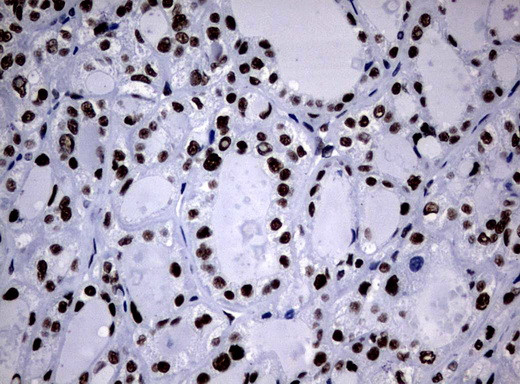 NBN Antibody in Immunohistochemistry (Paraffin) (IHC (P))