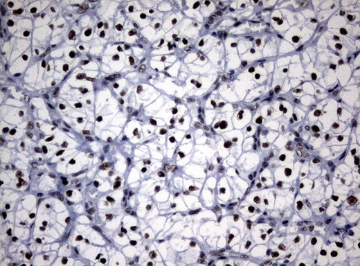 NBN Antibody in Immunohistochemistry (Paraffin) (IHC (P))