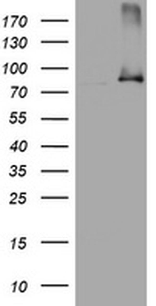 NBN Antibody in Western Blot (WB)