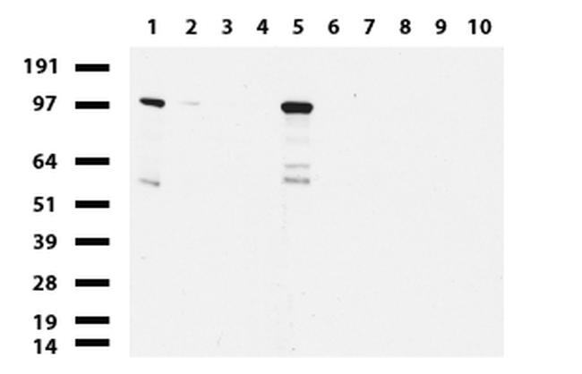 NBN Antibody in Western Blot (WB)