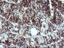 NCAM1 Antibody in Immunohistochemistry (Paraffin) (IHC (P))