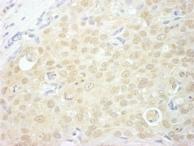 NCBP1/CBP80 Antibody in Immunohistochemistry (IHC)