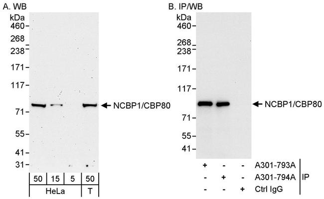 NCBP1/CBP80 Antibody in Western Blot (WB)