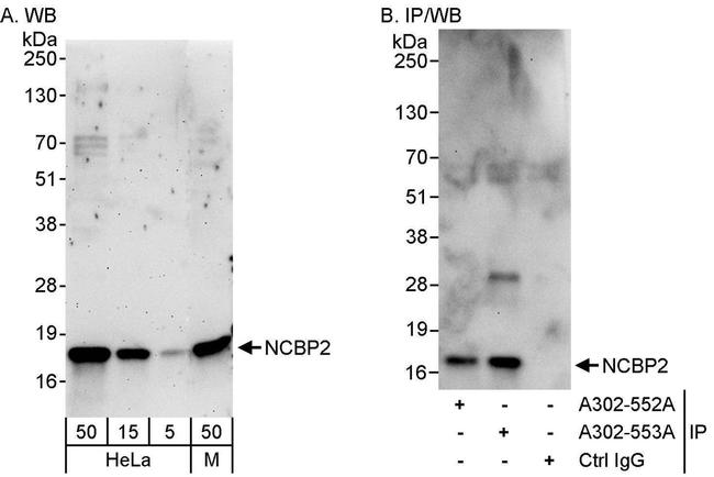 NCBP2 Antibody in Western Blot (WB)