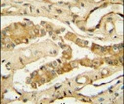 NDUFAF3 Antibody in Immunohistochemistry (IHC)