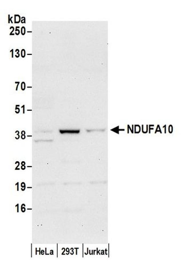 NDUFA10 Antibody in Western Blot (WB)