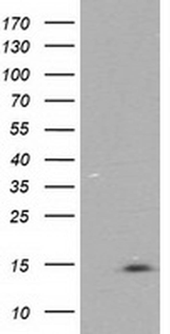 NDUFA7 Antibody in Western Blot (WB)