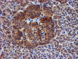 NDUFB9 Antibody in Immunohistochemistry (Paraffin) (IHC (P))