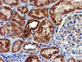 NDUFB9 Antibody in Immunohistochemistry (Paraffin) (IHC (P))