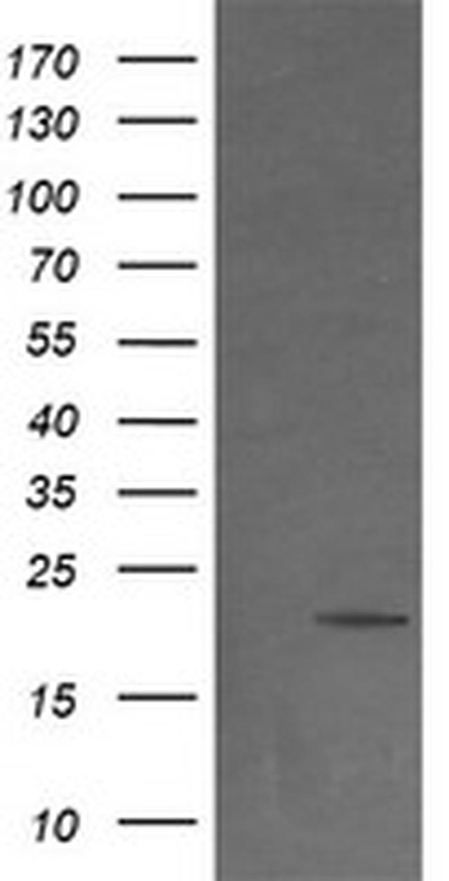 NDUFB9 Antibody in Western Blot (WB)