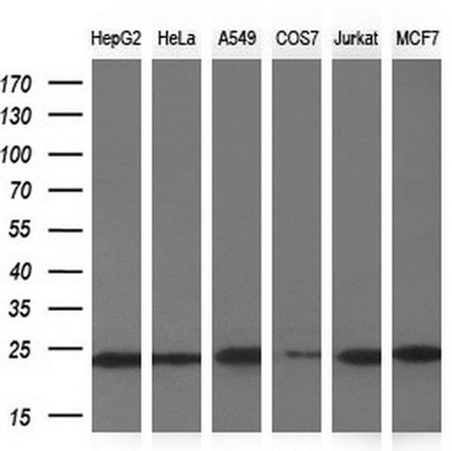 NDUFB9 Antibody in Western Blot (WB)