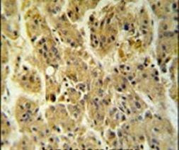 NDUFS2 Antibody in Immunohistochemistry (IHC)