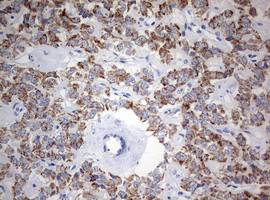 NDUFS2 Antibody in Immunohistochemistry (Paraffin) (IHC (P))