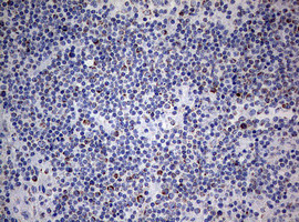 NDUFS2 Antibody in Immunohistochemistry (Paraffin) (IHC (P))