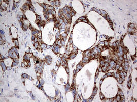 NDUFS2 Antibody in Immunohistochemistry (Paraffin) (IHC (P))