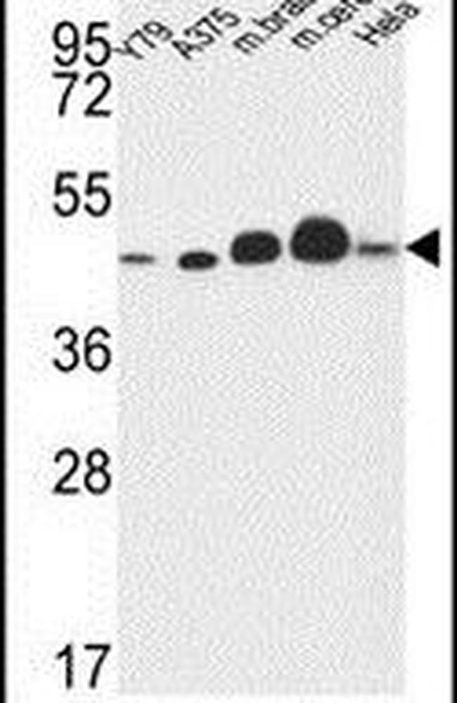 NDUFS2 Antibody in Western Blot (WB)