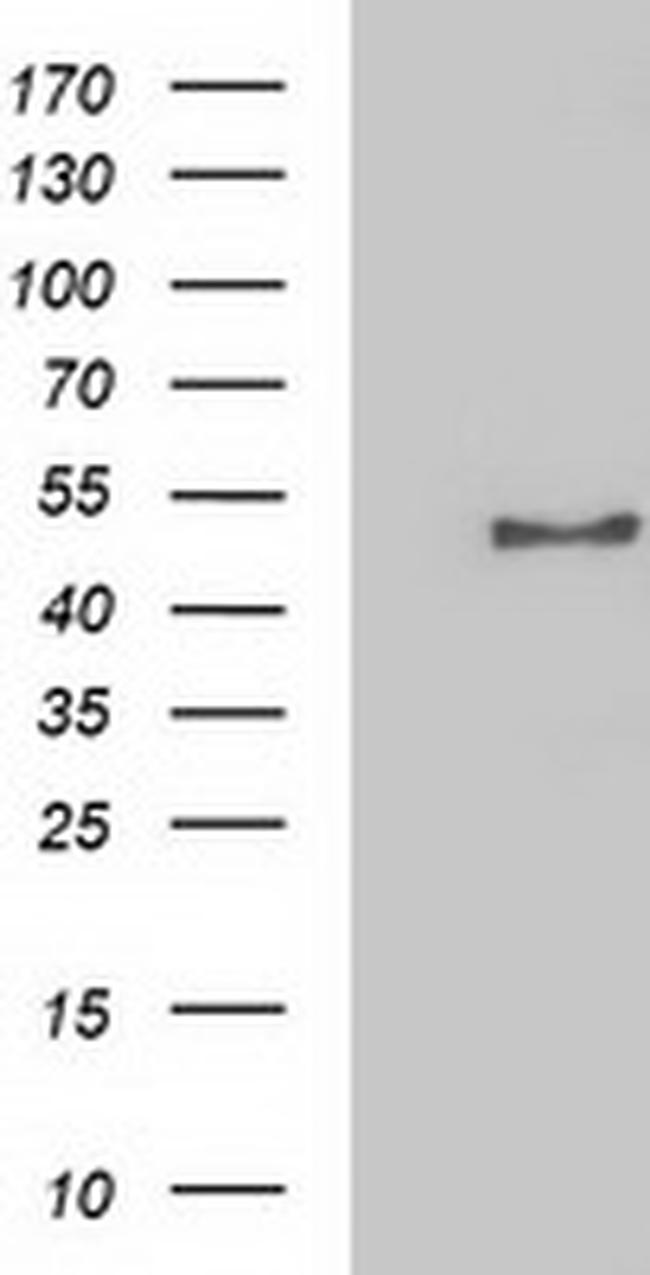 NECAB1 Antibody in Western Blot (WB)