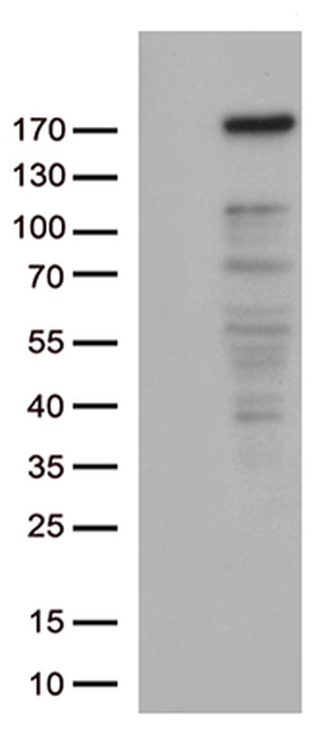 NEDD4 Antibody in Western Blot (WB)