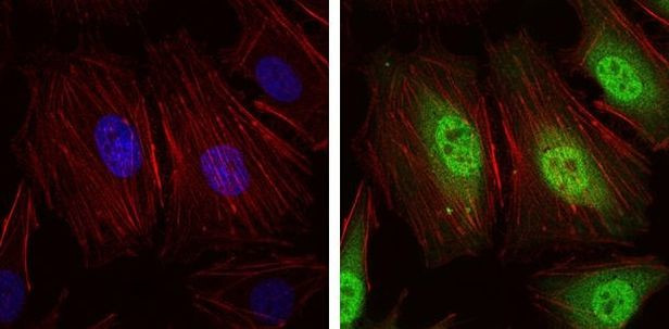 NEDD8 Antibody in Immunocytochemistry (ICC/IF)