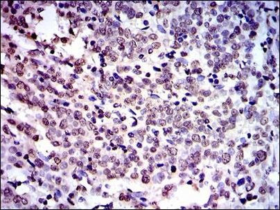 NEDD8 Antibody in Immunohistochemistry (Paraffin) (IHC (P))