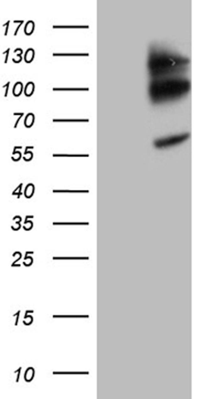 NEDD9 Antibody in Western Blot (WB)