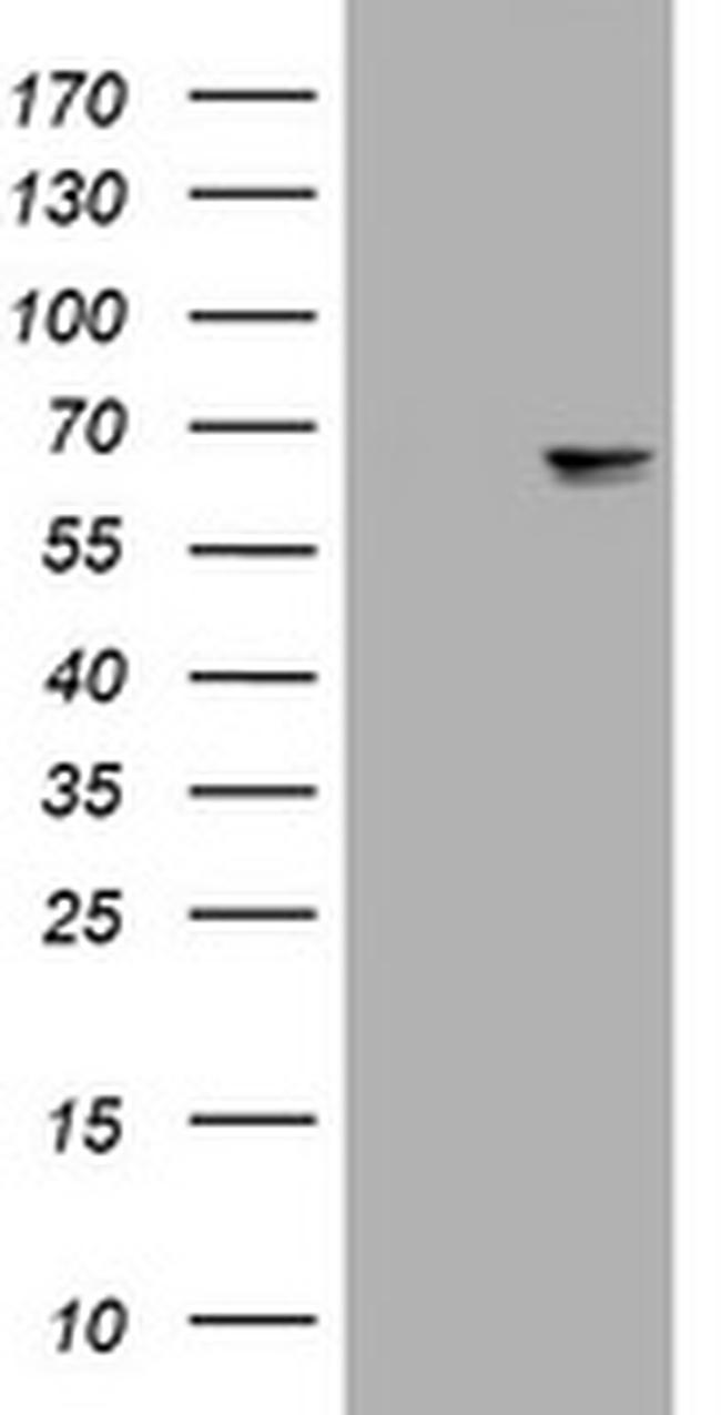 NEFL Antibody in Western Blot (WB)